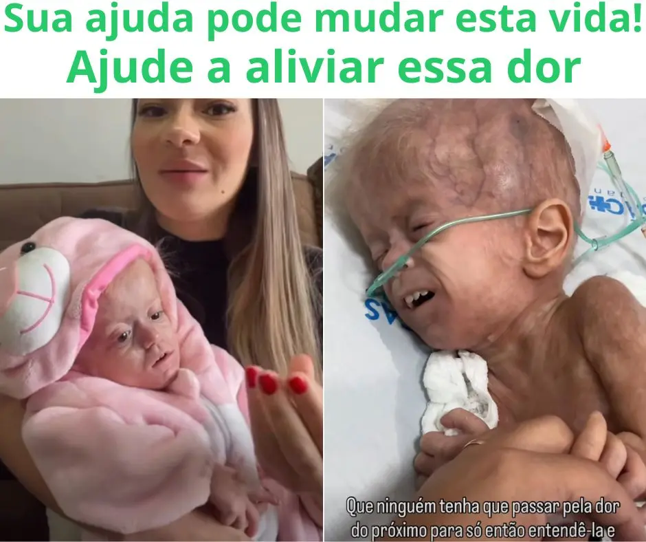 Aninha em tratamento